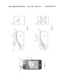 TISSUE EXPANDER IMPROVEMENTS diagram and image