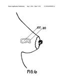 METHOD FOR UTILIZING AN IMPLANT IN A BODY OF A PATIENT diagram and image