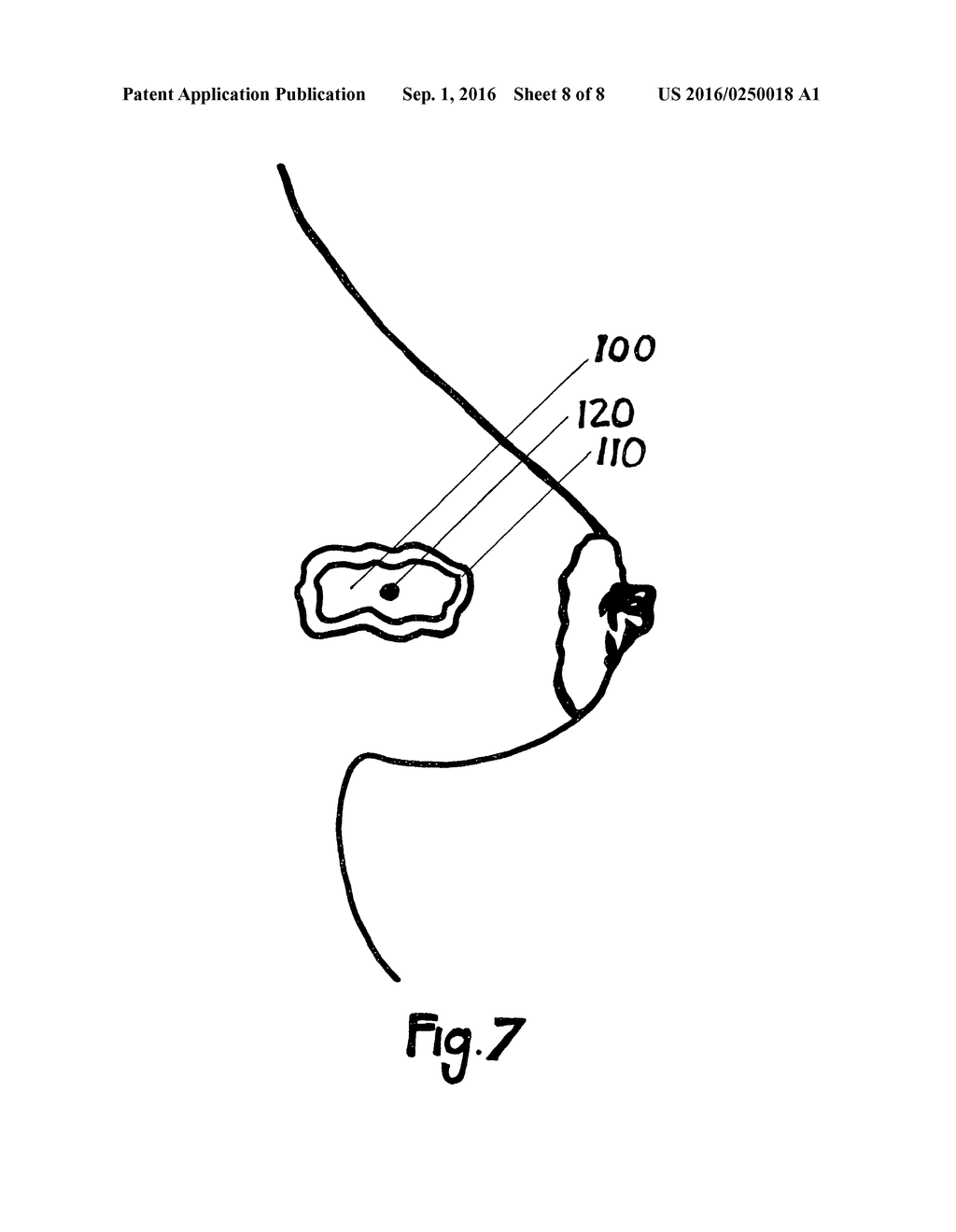 METHOD FOR UTILIZING AN IMPLANT IN A BODY OF A PATIENT - diagram, schematic, and image 09