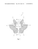 NEGATIVE-POSITIVE PRESSURIZABLE IMPLANT diagram and image