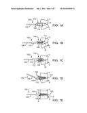 METHODS AND APPARATUS FOR INTERVERTEBRAL DISC PROSTHESIS INSERTION diagram and image