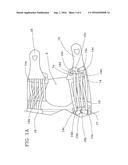 ORTHOPEDIC KNEEPAD diagram and image