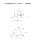 Refastenable Absorbent Article diagram and image