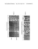 METHOD OF TREATING A MALIGNANCY IN A SUBJECT AND A PHARMACEUTICAL     COMPOSITION FOR USE IN SAME diagram and image