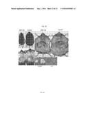 Peptide for Suppressing and Treating Obesity diagram and image