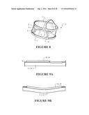 HEADGEAR diagram and image