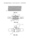 HME AND COMPACT BREATHING APPARATUS diagram and image