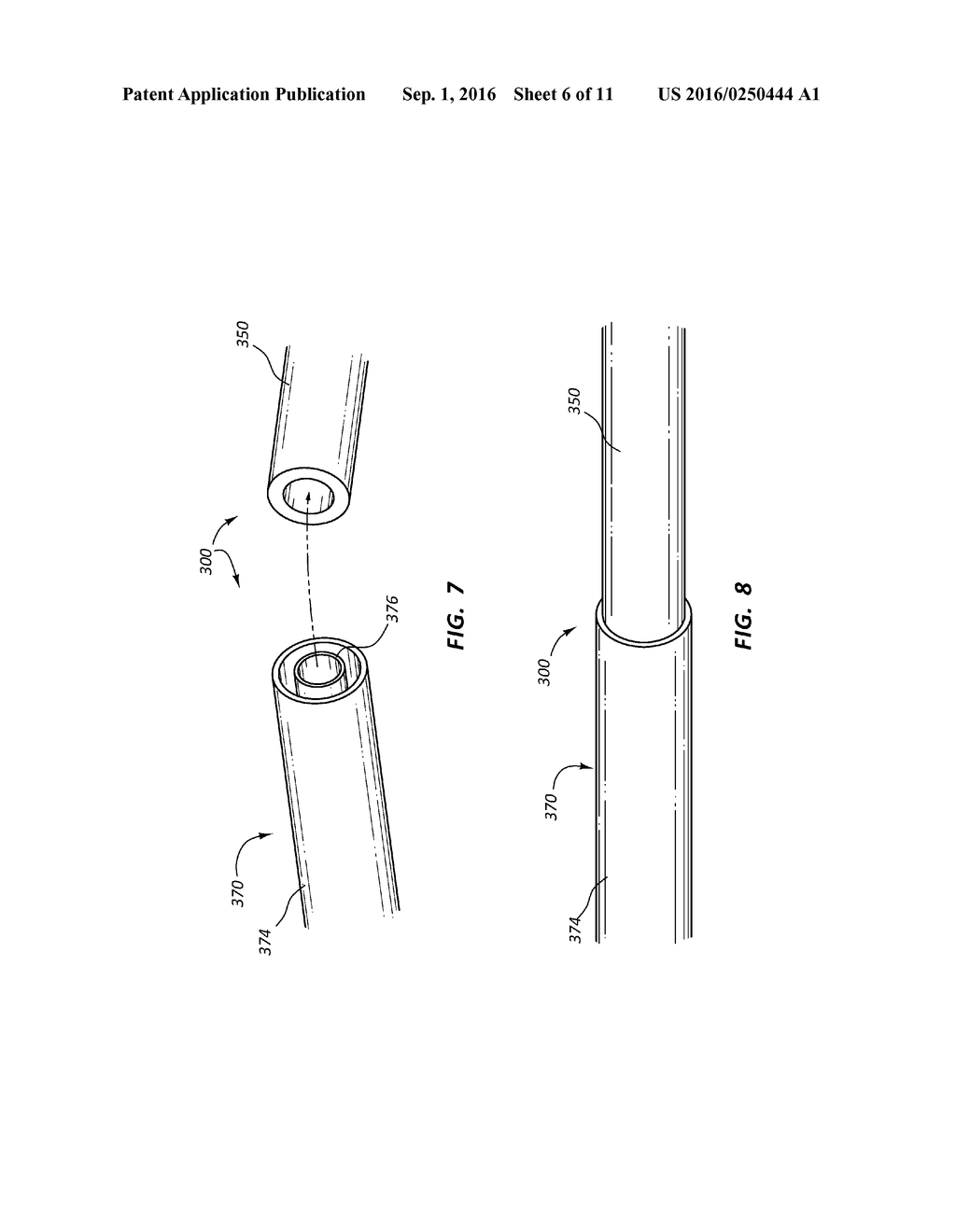 PRESSURE-SENSING CATHETERS AND RELATED METHODS - diagram, schematic, and image 07