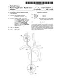 Intravascular Electrode System and Method diagram and image