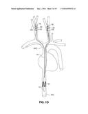 Intravascular Electrode System and Method diagram and image