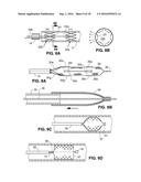 Intravascular Electrode System and Method diagram and image