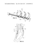 Intravascular Electrode System and Method diagram and image