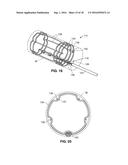 Intravascular Electrode System and Method diagram and image