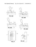 Intravascular Electrode System and Method diagram and image