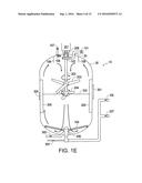 SCRUBBING BACKWASH FILTER diagram and image