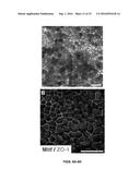 SUBSTANTIALLY PURE HUMAN RETINAL PROGENITOR, FOREBRAIN PROGENITOR, AND     RETINAL PIGMENT EPITHELIUM CELL CULTURES AND METHODS OF MAKING THE SAME diagram and image