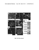 SUBSTANTIALLY PURE HUMAN RETINAL PROGENITOR, FOREBRAIN PROGENITOR, AND     RETINAL PIGMENT EPITHELIUM CELL CULTURES AND METHODS OF MAKING THE SAME diagram and image