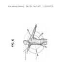 NANOPARTICLE ASSISTED SCANNING FOCUSING X-RAY FLUORESCENCE IMAGING AND     ENHANCED TREATMENT diagram and image