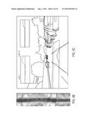 ROAD VERTICAL CONTOUR DETECTION USING A STABILIZED COORDINATE FRAME diagram and image