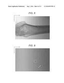 MEDICAL IMAGE SYSTEM AND IMAGE PROCESSING DEVICE diagram and image