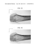 MEDICAL IMAGE SYSTEM AND IMAGE PROCESSING DEVICE diagram and image