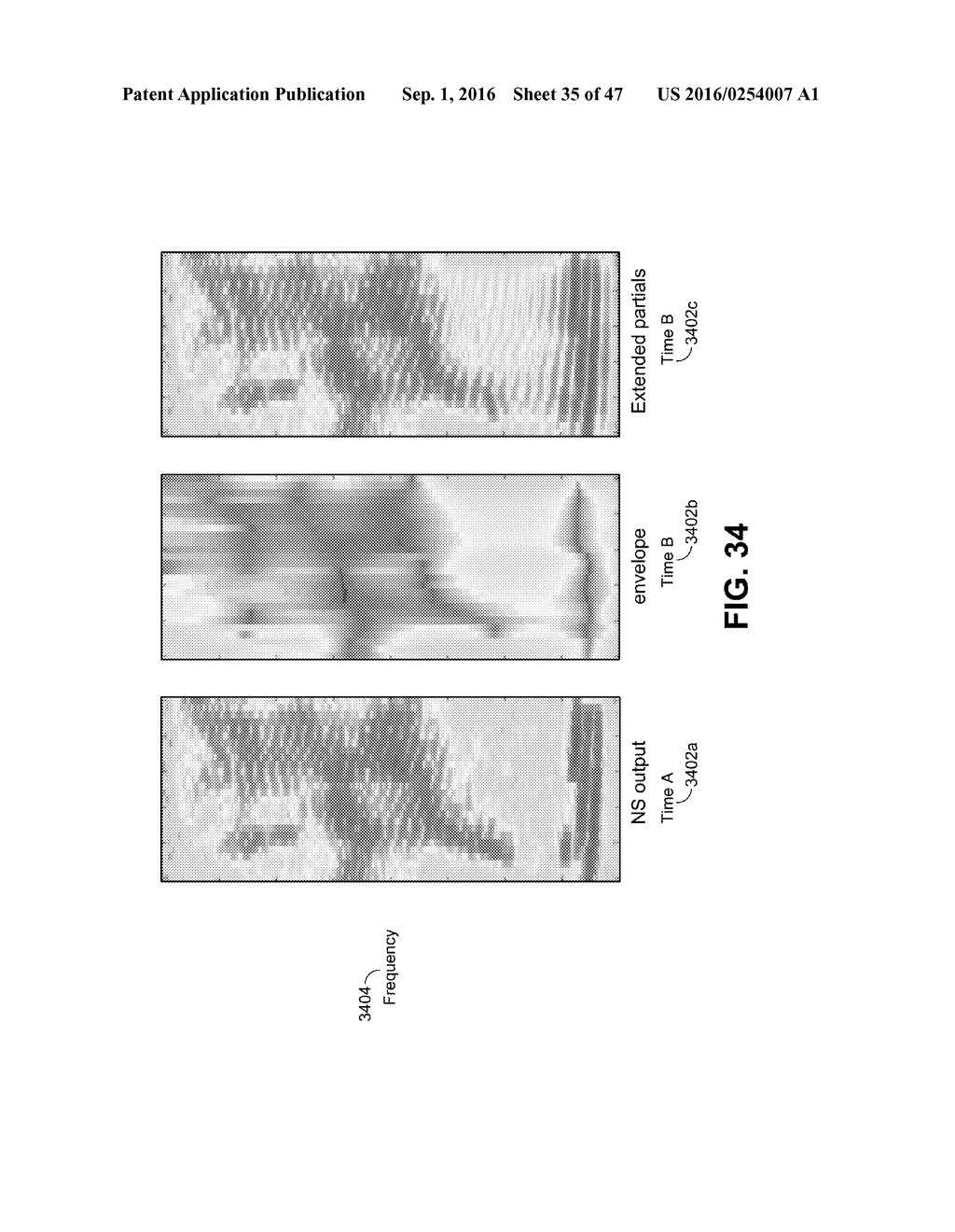 SYSTEMS AND METHODS FOR SPEECH RESTORATION - diagram, schematic, and image 36