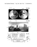 Non-Interference Field-of-view Support Apparatus for a Panoramic Sensor diagram and image