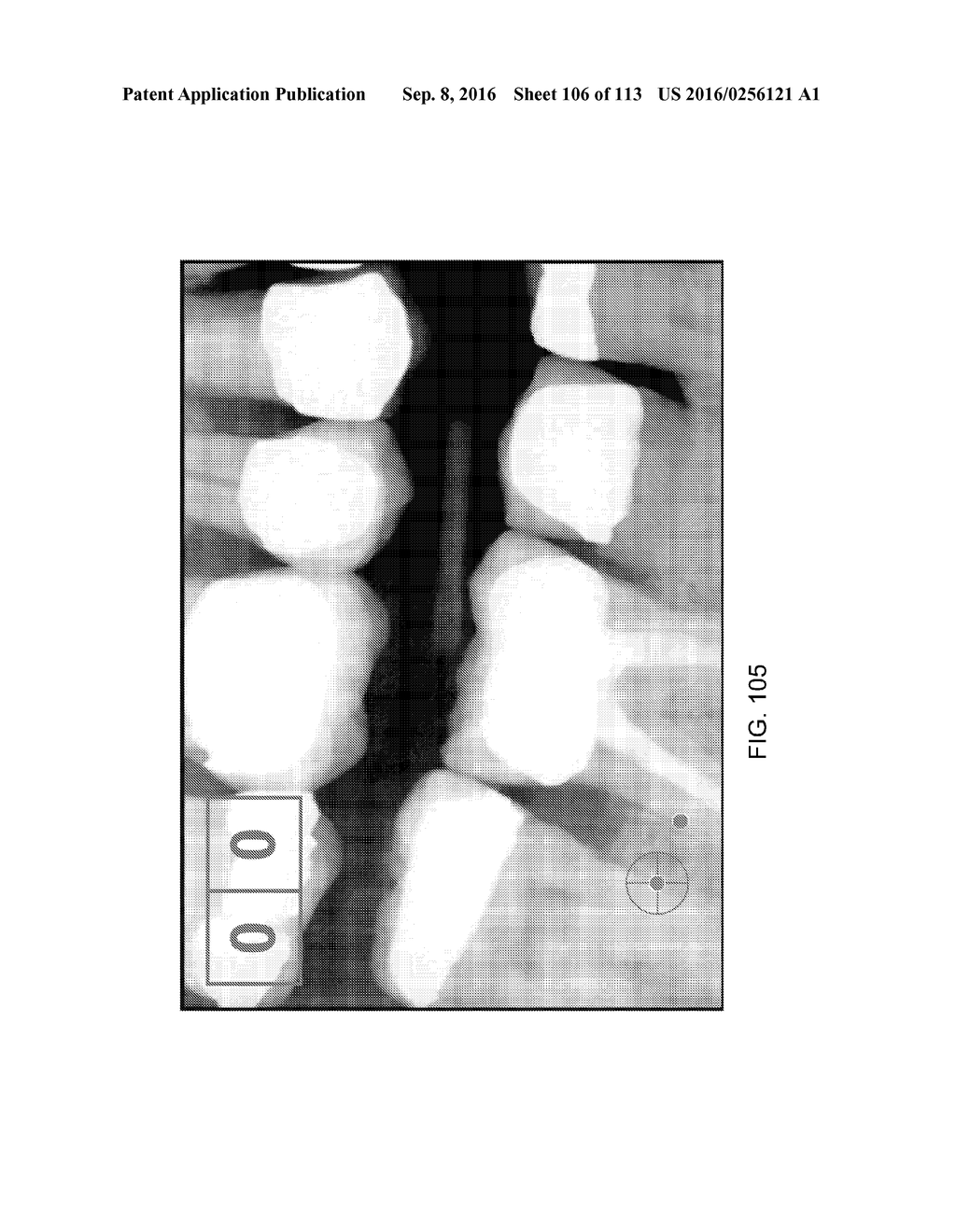 DIGITAL X-RAY DIAGNOSIS AND EVALUATION OF DENTAL DISEASE - diagram, schematic, and image 107