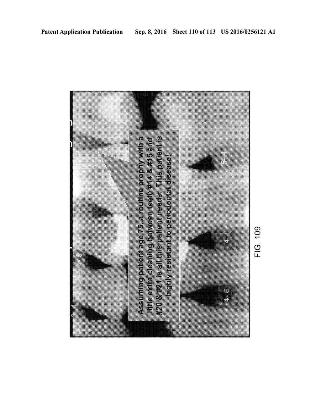 DIGITAL X-RAY DIAGNOSIS AND EVALUATION OF DENTAL DISEASE - diagram, schematic, and image 111