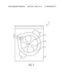 Long-Term Wear Electrode diagram and image