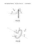 Catheter systems diagram and image