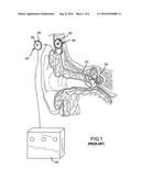 INTEGRATED IMPLANTABLE HEARING DEVICE, MICROPHONE AND POWER UNIT diagram and image