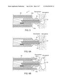 REDUCED PROFILE AND ENHANCED FLEXIBILITY DELIVERY CATHETERS FOR LIGHT     ACTIVATED AGENTS diagram and image