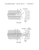 REDUCED PROFILE AND ENHANCED FLEXIBILITY DELIVERY CATHETERS FOR LIGHT     ACTIVATED AGENTS diagram and image
