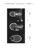 SYSTEM AND METHOD FOR PATIENT-SPECIFIC RADIOTHERAPY TREATMENT VERIFICATION     AND QUALITY ASSURANCE SYSTEM diagram and image