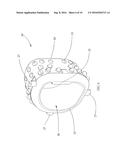 Air-Filtering Device diagram and image