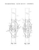 CENTRALIZER WITH COLLABORATIVE SPRING FORCE diagram and image