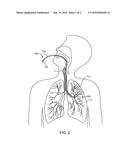 METHODS AND SYSTEMS FOR ENDOBRONCHIAL DIAGNOSIS diagram and image