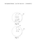 SYSTEMS AND METHODS FOR COLLECTING FLUID FROM A SUBJECT diagram and image