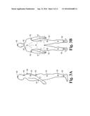 SYSTEM AND APPARATUS FOR POSTURE AND BODY POSITION CORRECTION AND     IMPROVEMENT THROUGH A COMPUTER-ASSISTED BIOFEEDBACK SYSTEM diagram and image