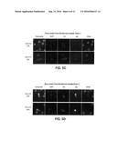 Genotypic and Phenotypic Analysis of Circulating Tumor Cells to Monitor     Tumor Evolution in Prostate Cancer Patients diagram and image