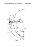 Voice Sensing using Multiple Microphones diagram and image