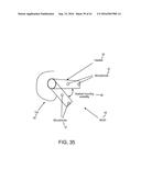 SYSTEMS, METHODS, APPARATUS, AND COMPUTER-READABLE MEDIA FOR ADAPTIVE     ACTIVE NOISE CANCELLATION diagram and image