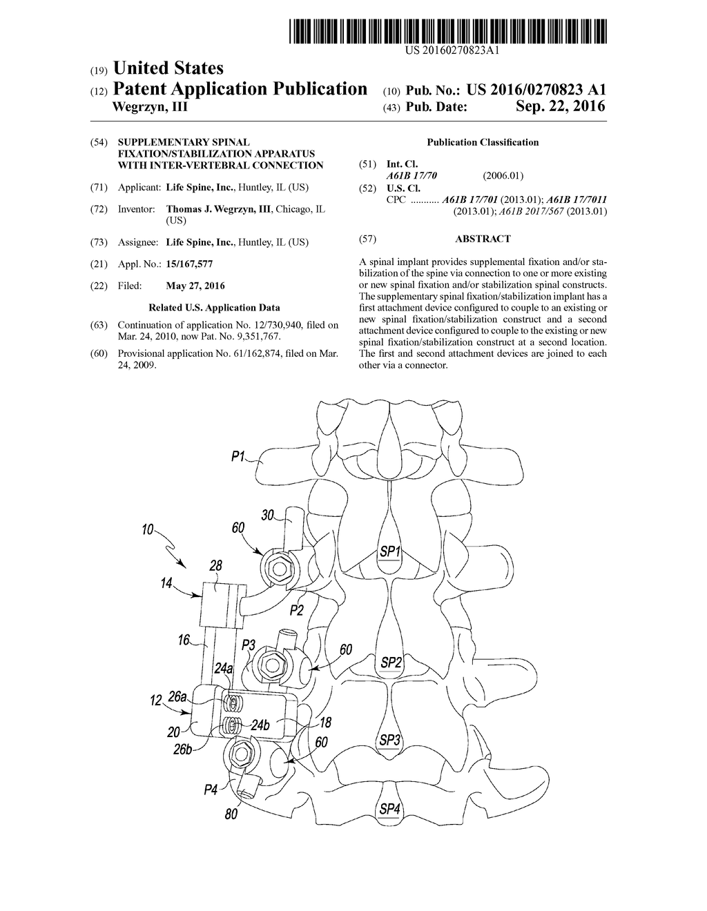 SUPPLEMENTARY SPINAL FIXATION/STABILIZATION APPARATUS WITH INTER-VERTEBRAL     CONNECTION - diagram, schematic, and image 01