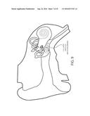 TREATING AND DETECTING BIOLOGIC TARGETS SUCH AS INFECTIOUS DISEASES diagram and image