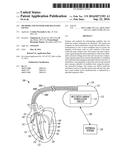 METHODS AND SYSTEMS FOR MULTI-SITE PACING diagram and image