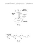 AUTONOMIC MODULATION USING TRANSIENT RESPONSE WITH INTERMITTENT NEURAL     STIMULATION diagram and image