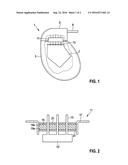 Implantable Electromedical Device diagram and image