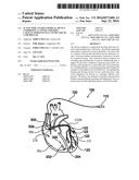 ACTIVE IMPLANTABLE MEDICAL DEVICE COMPRISING A CONNECTOR-FREE CAPSULE,     PERMANENTLY CONNECTED TO A MICROLEAD diagram and image