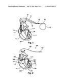 ACTIVE IMPLANTABLE MEDICAL DEVICE COMPRISING A CONNECTOR-FREE CAPSULE,     PERMANENTLY CONNECTED TO A MICROLEAD diagram and image